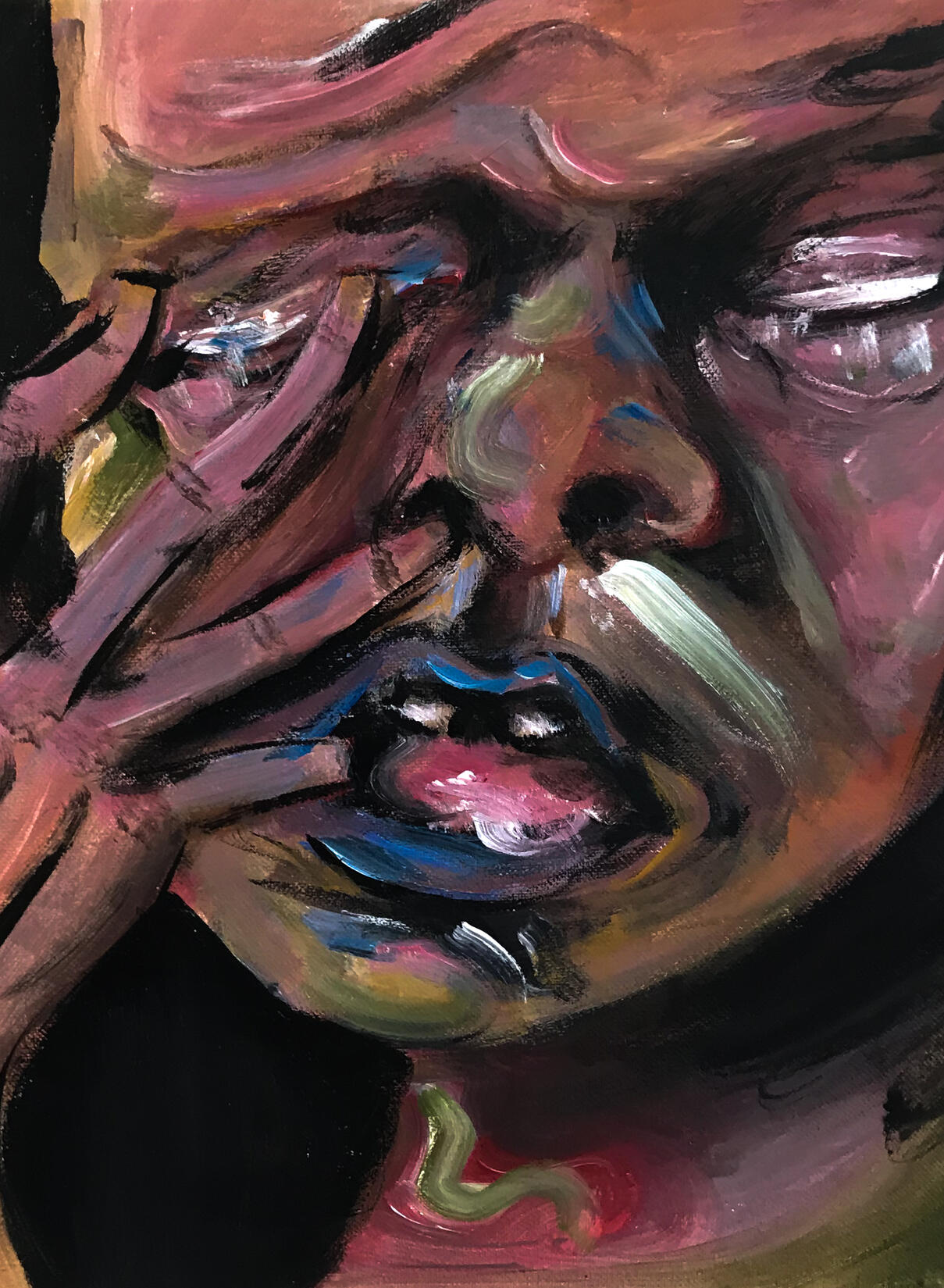 Represents trauma caused by an accident (drunk driving)